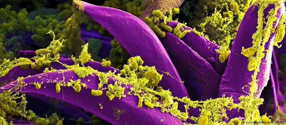 Yersinia pestis, bactéria causadora da peste