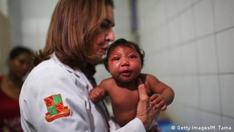 Brasilien Recife Baby mit Mikrozephalie
