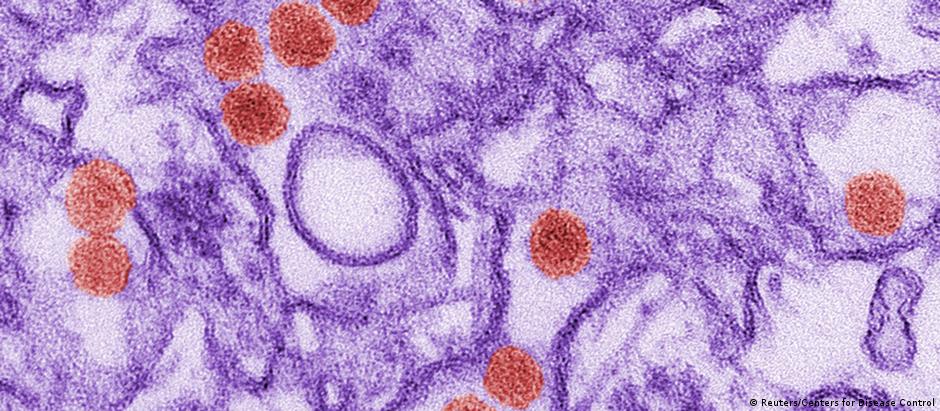 Mulher infectada pelo vírus zika está na vigésima semana de gravidez