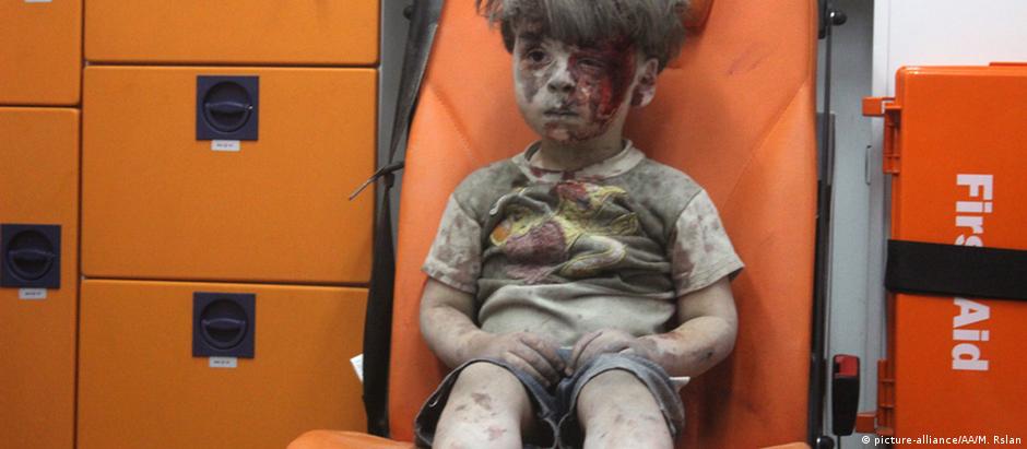 Ali Daqneesh, irmão de Omran (na foto), não resistiu aos ferimentos do ataque aéreo e morreu em Aleppo