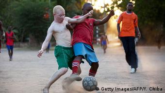 Tansania Albino United football Club (Getty Images/AFP/Y. Chiba)