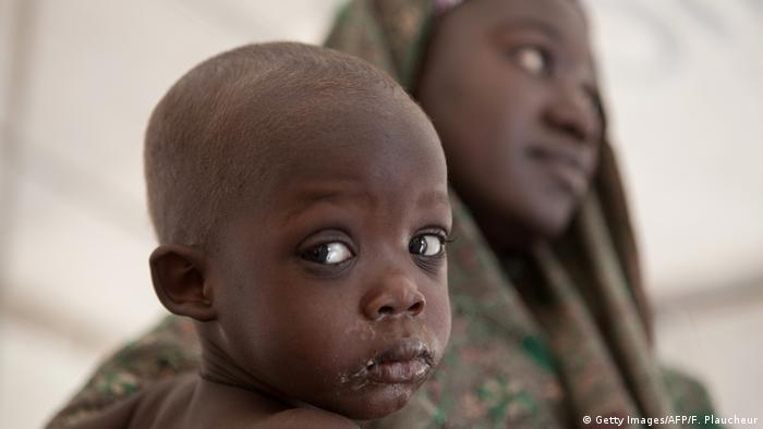 NIGERIA Hunger und Mangelernährung (Getty Images/AFP/F. Plaucheur)
