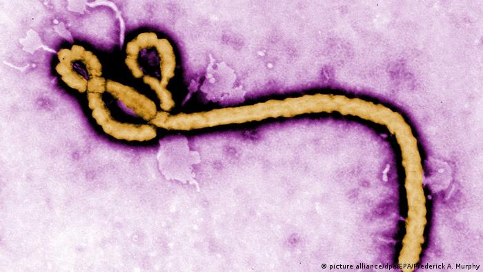 Ebola virus (picture alliance/dpa/EPA/Frederick A. Murphy)