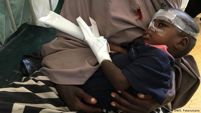   A child with a bandaged head and a hand holding the needle and feeding tube (DW / S. Petersmann) 