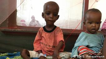 Somalia Mogadischu | unterernährtes Kleinkind (DW/S. Petersmann)