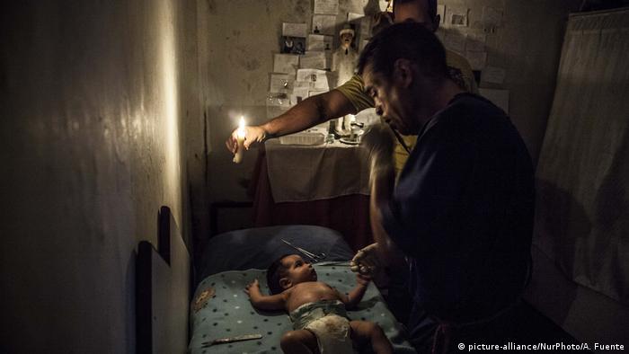 Bebê é tratado com medicina alternativa na favela de Petare, em Caracas