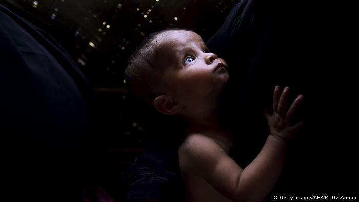 Unterernährung von Kleinkindern in Bangladesh (Getty Images/AFP/M. Uz Zaman)