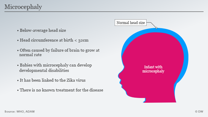 Infographic illustrating issues caused by microcephaly