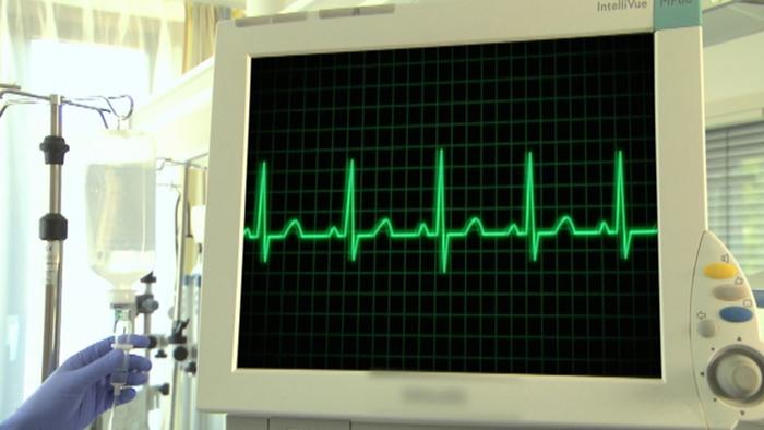 جهاز تخطيط كهربائية القلب تشخيص حال القلب صحتك بين يديك Dw 16 10 2014