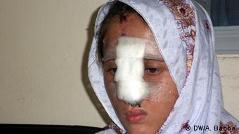Pakistan Gewalt gegen Frauen Shahida (DW/A. Bacha)