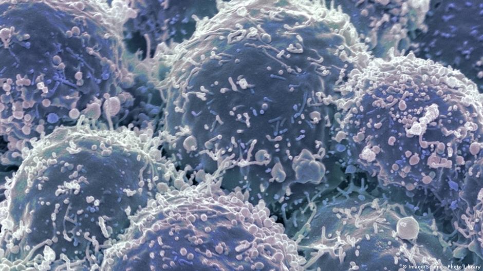 Krebs Krebszelle Illustration Lungenkrebs
