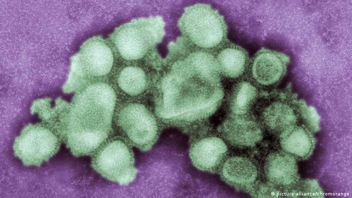 Influenza-A-Virus H1N1 (picture-alliance/chromorange)