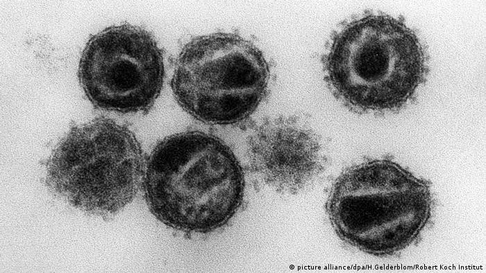 Electron microscope image of HIV viruses (picture alliance/dpa/H.Gelderblom/Robert Koch Institut)