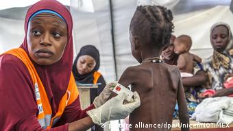 Hungersnot in Nigeria (picture alliance/dpa/Unicef/NOTIMEX)