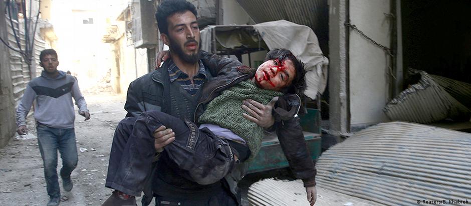 Criança ferida durante combates na região de Ghouta Oriental, em 21 de fevereiro