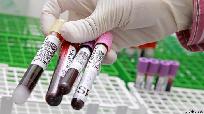 Mão com luva descartável segura quatro tubos de ensaio com amostras de sangue em laboratório