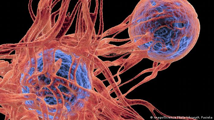 Melanoma - Hautkrebs - Illustration der Krebszellen (Imago / Science Photo Library / A. Pasieka)