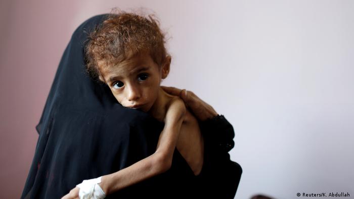 ООН: В Йемене из-за войны каждый 10 минут умирает ребенок