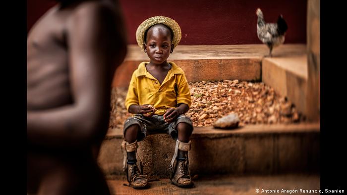 UNICEF: Foto des Jahres 2018 Platz 1 (Antonio AragÃ³n Renuncio, Spanien)