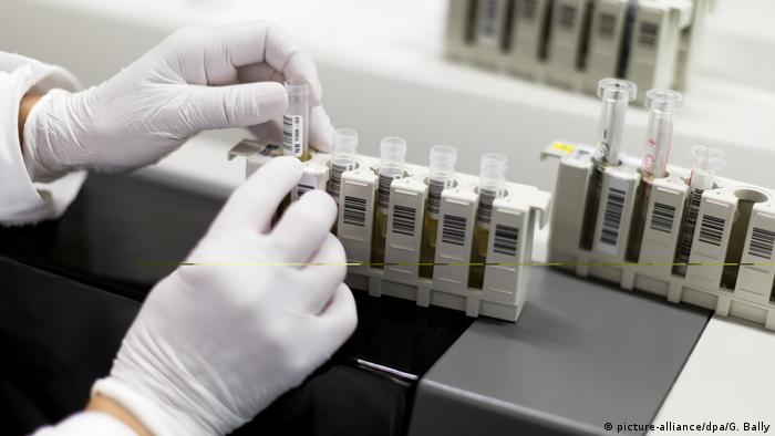 Teste de HIV em laboratório. Caso do paciente de Londres poderá resultar em avanços futuros no combate ao vírus HIV