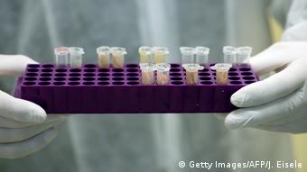 DNA-Test (Getty Images/AFP/J. Eisele)