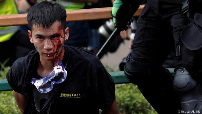 Honkong Proteste Polytechnische Universität | Verletzter (Reuters/T. Siu)