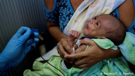 Un bebé diagnosticado con desnutrición en Venezuela. Foto de 2019.