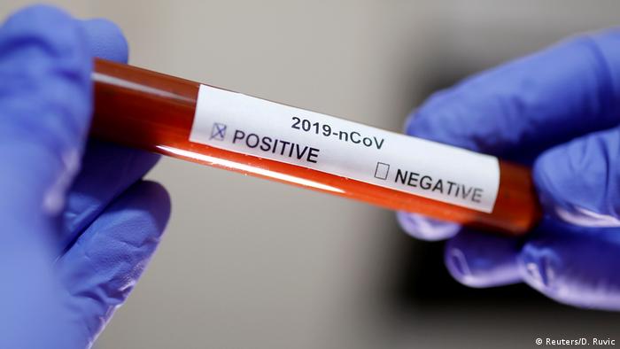 Mãos com luvas seguram tubo com sangue e etiquete indicando coronavírus