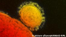 Coronavirus SARS-CoV-2 im Elektronenmikroskop (picture-alliance/AP/NIAID-RML)