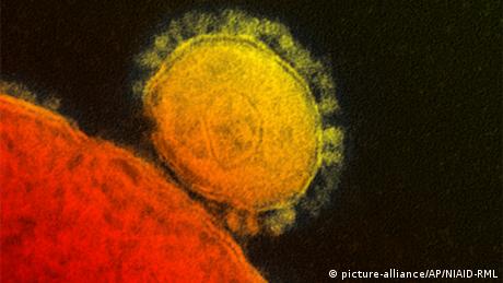 Coronavirus SARS-CoV-2 im Elektronenmikroskop (picture-alliance/AP/NIAID-RML)