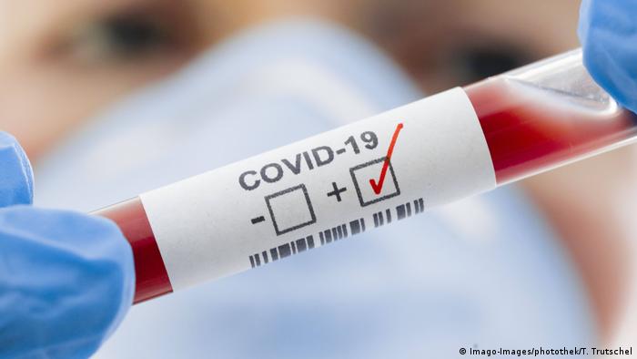 Германски учени съобщиха за пробив в борбата срещу коронавирус ...