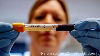 Foto de laboratorista con muestra de sangre