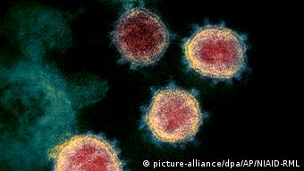 Coronavirus im Elektronenmikroskop (picture-alliance/dpa/AP/NIAID-RML)