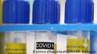 Наявність антитіл у крові не завжди є доказом того, що людина перехворіла на COVID-19