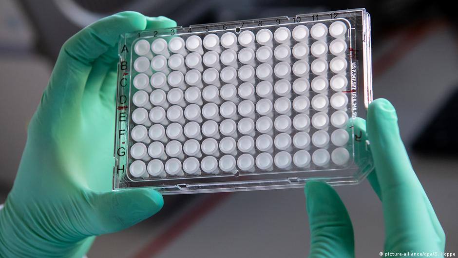 目前全球大多數檢測都使用一種叫做PCR的技術，它可以檢測出咽拭子中的冠狀病毒