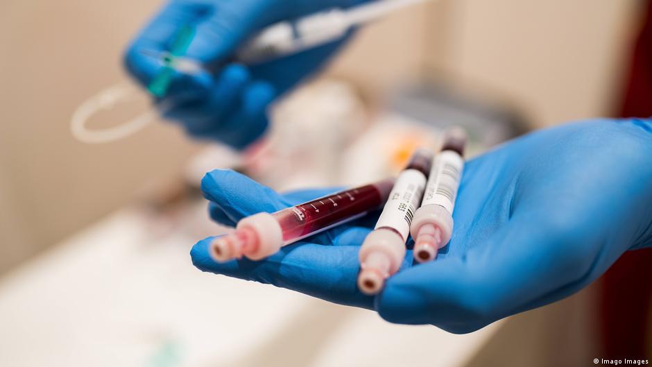 Symbolbild Bluttest Antikörpertest Test Coronavirus 