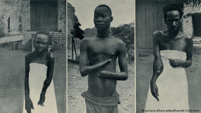 Kongogräuel im Kongo-Freistaat
(picture-alliance/dpa/Everett Collection
)